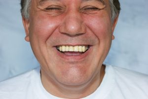 laughing man shows off bridge of false teeth