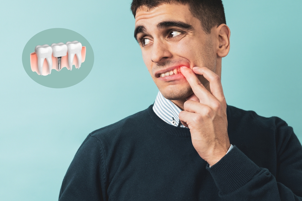 dental implant emergencies