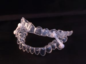 oral appliance