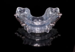 oral appliance therapy for sleep apnea