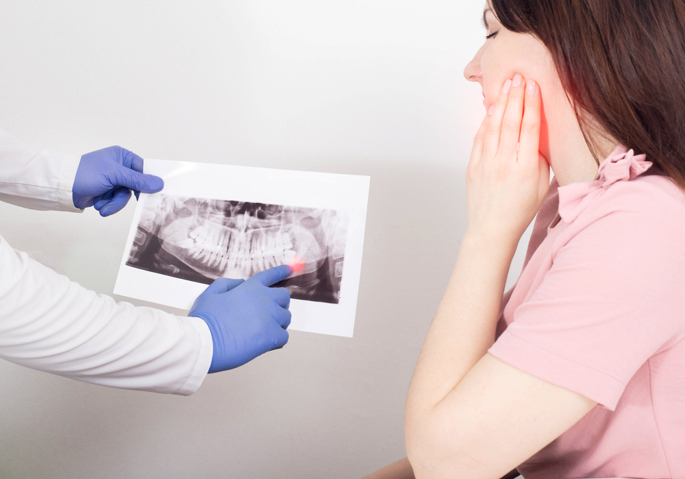 wisdom tooth removal x-ray